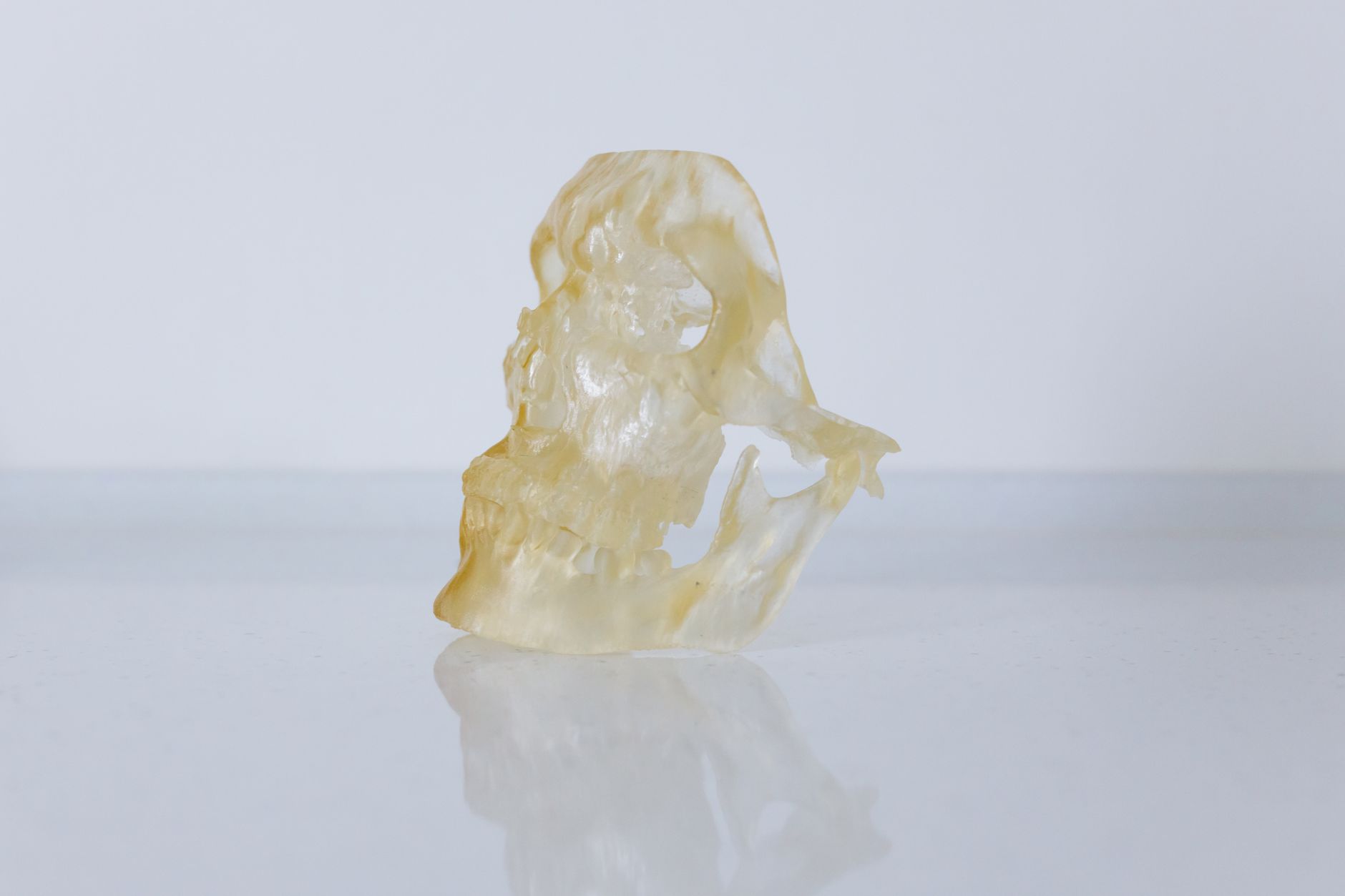 Precision medicine advances in UAE with 3D-printed guides for spinal surgery at Medcare Orthopaedics and Spine Hospital
